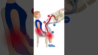The Stretch Reflex Rewiring with PRRT.