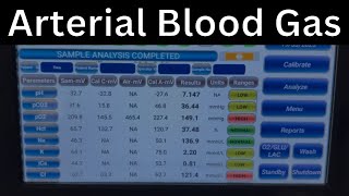 How To Do Abg Arterial Blood Gas Vbg Venous Blood Gas