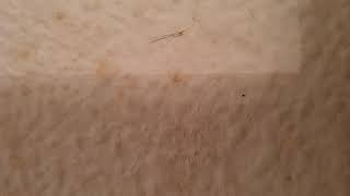 Small bugs on wall