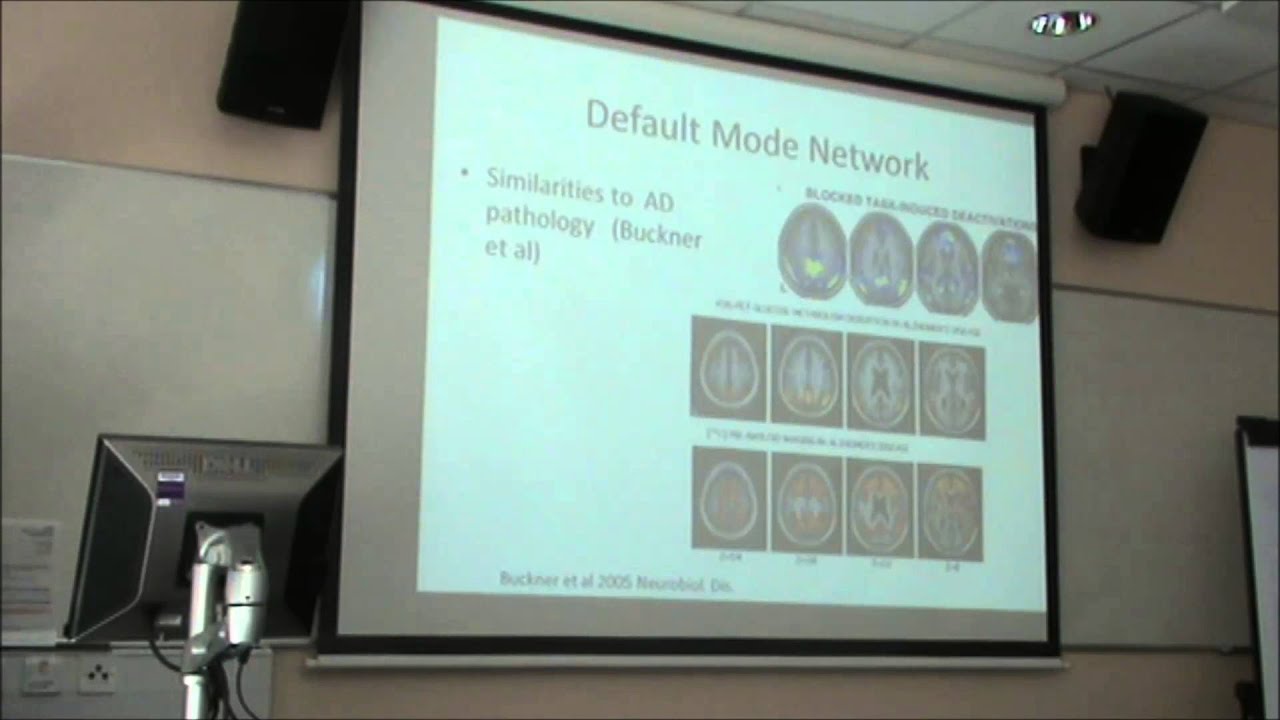 Functional MRI study of attentional dysfunction in Lewy body dementia ...