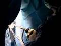 Endometrial Ablation - Alternative to Hysterectomy