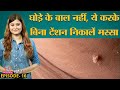 मस्से या Skin Tags आपकी Skin पर क्यों हो जाते हैं और इनसे कैसे निपटा जाए? Sehat Ep 16