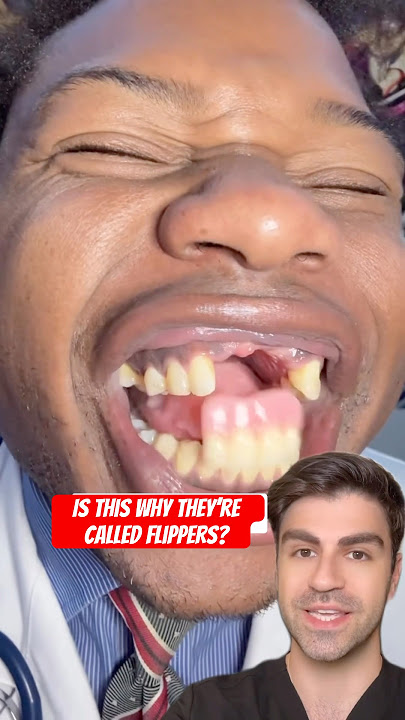 Download lagu THIS Is How You Lose Your Teeth