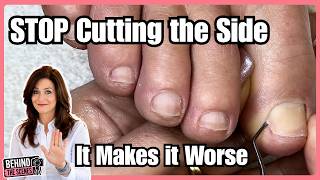Ingrown Toenail Pain? She Thought She Needed Surgery… But This Was Hiding Inside