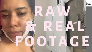 After Plastic Surgery Recovery House Nightmare Review Spa Medical Jm - Medical Tourism Dr Vlog Pt 3