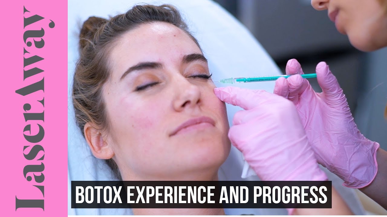 Пробую ботокс в первый раз | LaserAway