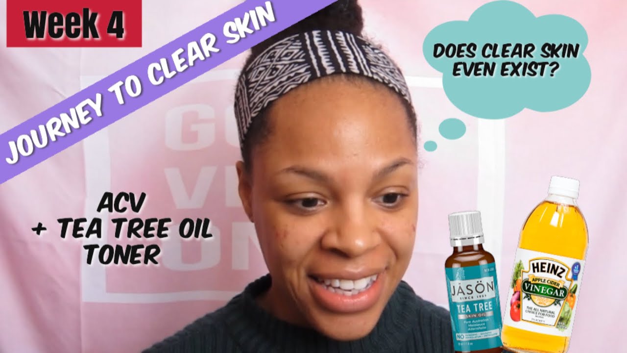 DIY Acne Toner Using Apple Cider Vinegar & Tea Tree Oil //Chit Chat