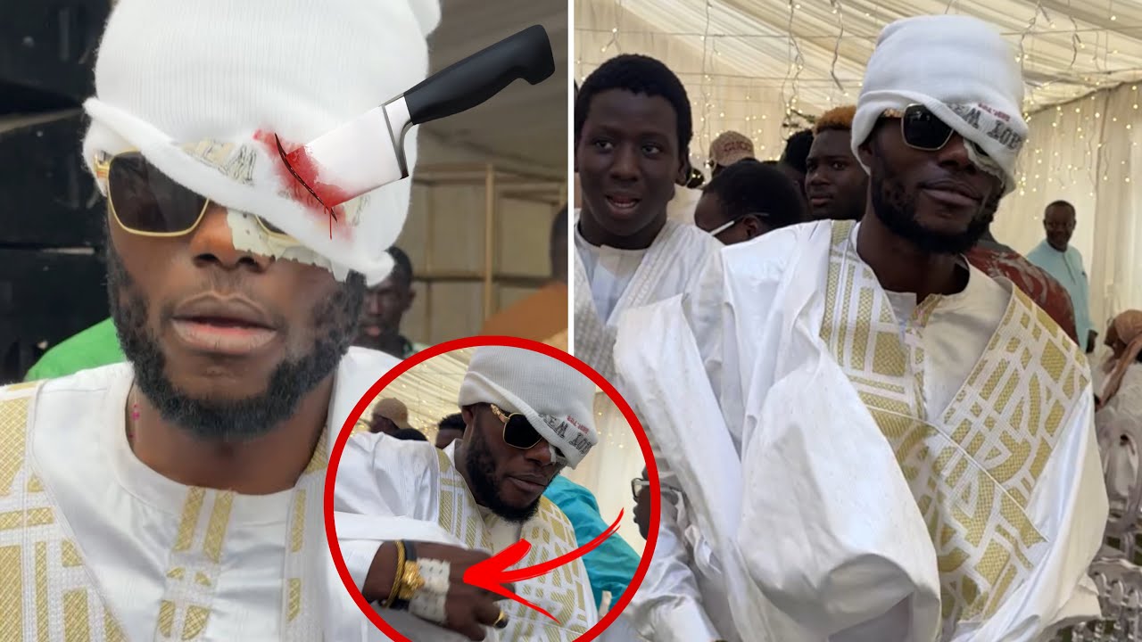 Urgent: Délégué Amar gravement blessé, après sa b@garre débarque au mariage de cheikh dérangé