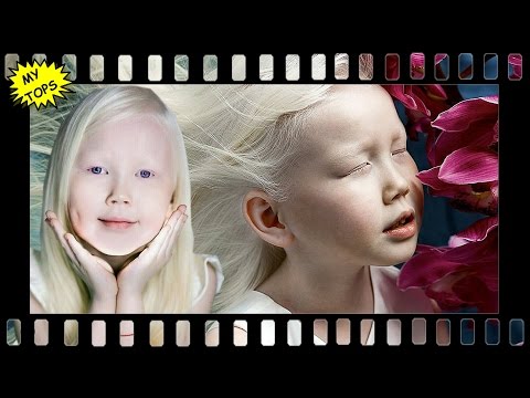 Нарияна - Сибирская Белоснежка из Якутии | ФАРФОРОВАЯ ДЕВОЧКА АЛЬБИНОС | САМЫЕ УДИВИТЕЛЬНЫЕ ЛЮДИ