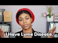 When Life Gives You LYME. - Life/Health Update 2018 - Lyme Disease - NaturalMe4C