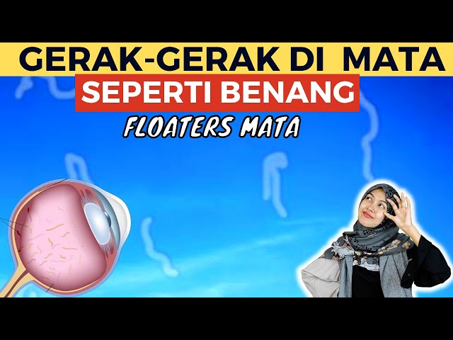 PANDANGAN MATA MUNCUL BAYANGAN CACING TALI BENANG DEBU BERCAK BERGERAK GERAK/FLOATERS MATA class=