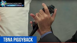 Flexible Bronchoscopy Basic Techniques 3 - TBNA Piggyback