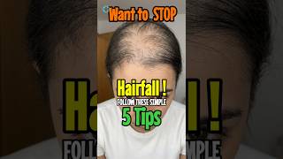 🔥Say GOODBYE👋 To Hairfall With these 5 Easy Tips😱✅#HairFall #shorts