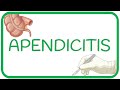 APENDICITIS - causas, fisiopatología, síntomas, diagnóstico y tratamientos  |  CIRUGÍA