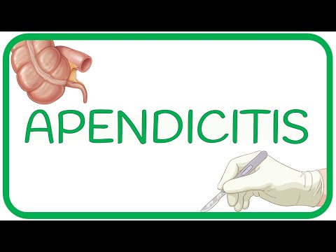 Vídeo: Infiltrado Apendicular: Causas, Síntomas, Diagnóstico Y Tratamiento Del Infiltrado Apendicular