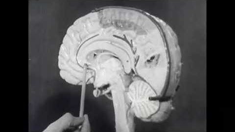 Split Brain; Psychobiology.