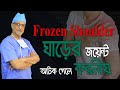 Frozen shoulder causes and treatment of frozen shoulderprof dr m amjad hossain