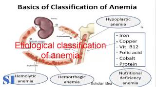 Types of #anemia أنواع الأنيميا