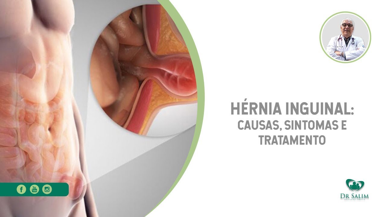 Hérnia do esporte: causas, sintomas e tratamentos - Hernia Clinic