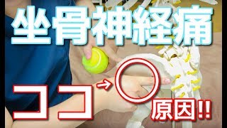 「お尻からふくらはぎまで痛いんです」って症状の原因、だいたい"◯◯"！　　　-整体院 福佳- 福岡 腰痛