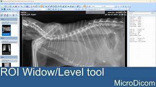 MicroDicom ROI Window/Level Tool Tutorial — Adjust Brightness & Contrast with Precision screenshot 2