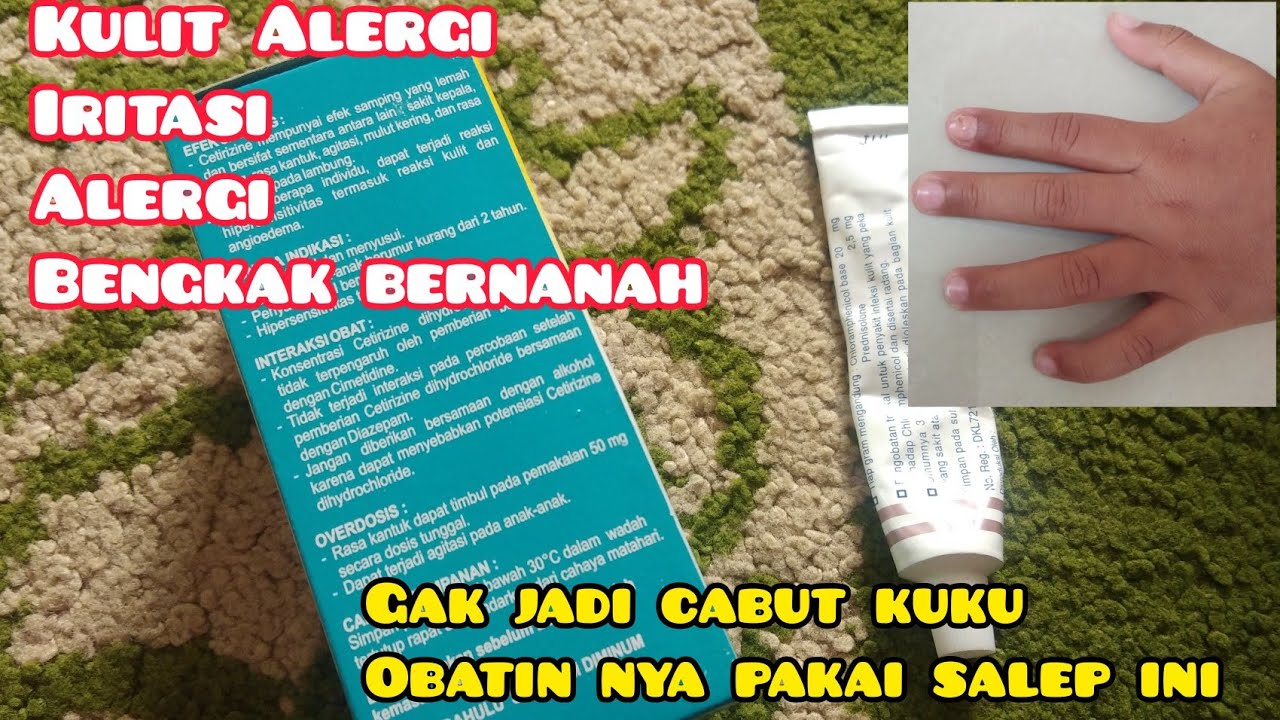 CARA MENGOBATI TANGAN CANTENGAN DAN BERNANAH I PENYEBAB DAN CARA