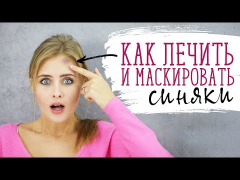 Как лечить и маскировать синяки [Шпильки | Женский журнал]