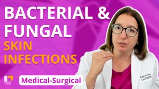 Bacterial & Fungal Skin Infections: Integumentary System  MedicalSurgical | @LevelUpRN