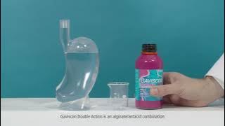 How Gaviscon Double Action creates a protective barrier to help prevent reflux