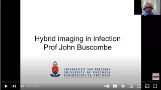 Prof John Buscombe - Hybrid imaging in infection