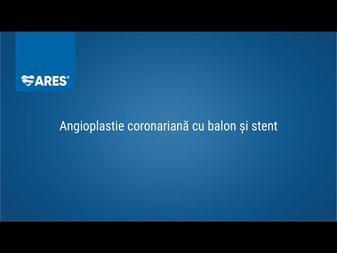 Video: Diferența Dintre Angioplastie și Stent