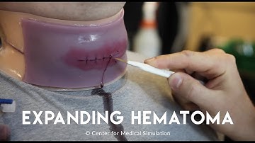 Moulage 101: Expanding Hematoma | Mad Simulationist