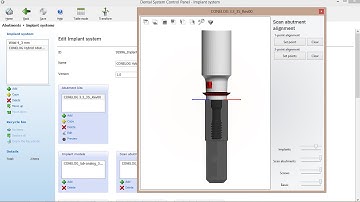 How to add and edit an Implant System Library in 3Shape Dental System 2015