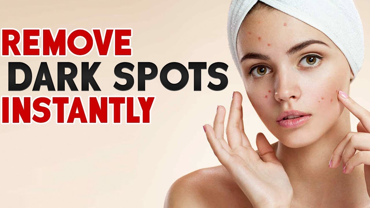 How To Remove Dark Spots How To Clear Skin Dark Spots On Face