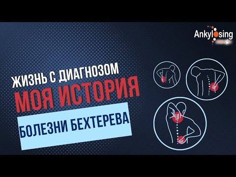 Жизнь с диагнозом болезнь Бехтерева|Моя история