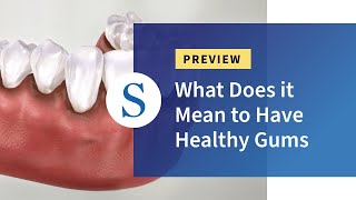 What Does it Mean to Have Healthy Gums. Patient Education Teaser.