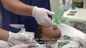 Paediatric Anaesthetics: Chapter 3 - Intubation non rsi