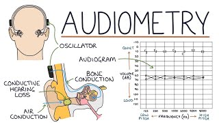 Audiometry and Audiograms | Drk