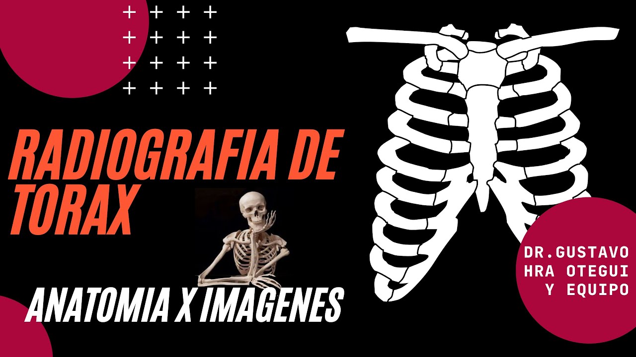 Radiografia de Torax