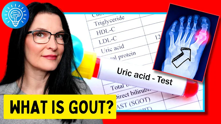 Gout 101: Everything You Need to Know