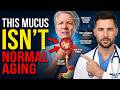 Why You Always Have Mucus In Your Throat— Doctor Explains the Real Cause