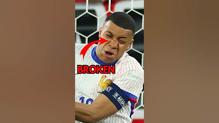 MBAPPE BROKE HIS NOSE🤕 #mbappe #football #euro