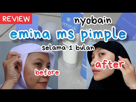 Hallo guys kali ini aku buat tutorial Cara pakai skincare dan yang kalian butuh kan saat memakai Ski. 