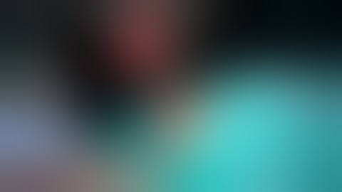 Proximal humerus fracture Open reduction and internal fixation/#Humerus#fracture #Operation