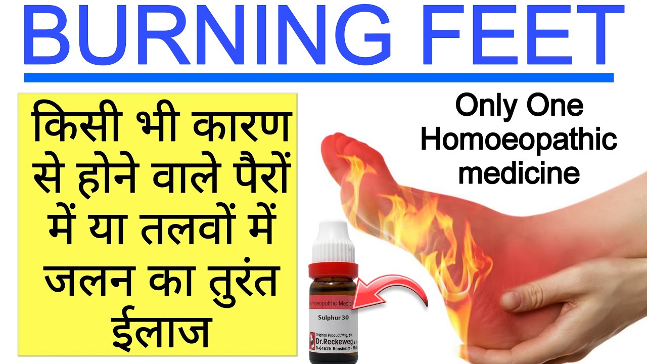 पैरों के तलवों में रात को होने वाली गर्मी,जलन एवं बेचैनी अब ख़त्म