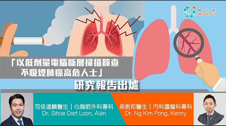 【肺癌治療】【肺癌篩查】「以低劑量電腦斷層掃瞄篩查不吸煙肺癌高危人士」研究報告出爐｜司徒達麟醫生﹑吳劍邦醫生 - 天天要聞