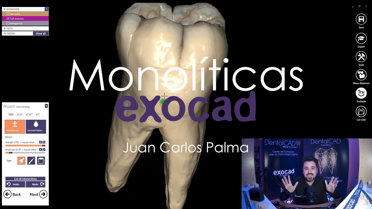 Caracterizaciones de Monolíticos en exocad - Juan Carlos Palma