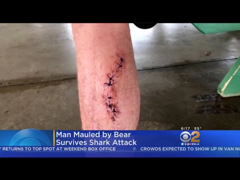 Bear Mauling, Snakebite Survivor Attacked By Shark