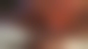 Donor hepatectomy-parenchymal transection (2nd part)