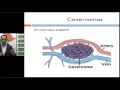 Non-neoplastic Vascular Malformations of the Brain #Radiology Spotter Series by Dr Sumer Sethi